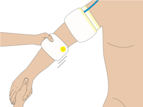 Roll-On Cuff