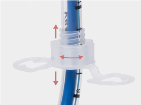 Özel olarak tasarlanmış trakeal tüp, standart trakeostomi tüpünden daha uzundur ve ayarlanabilir flanşı ile hastanın anatomik koşullarına bireysel adaptasyon sağlar.